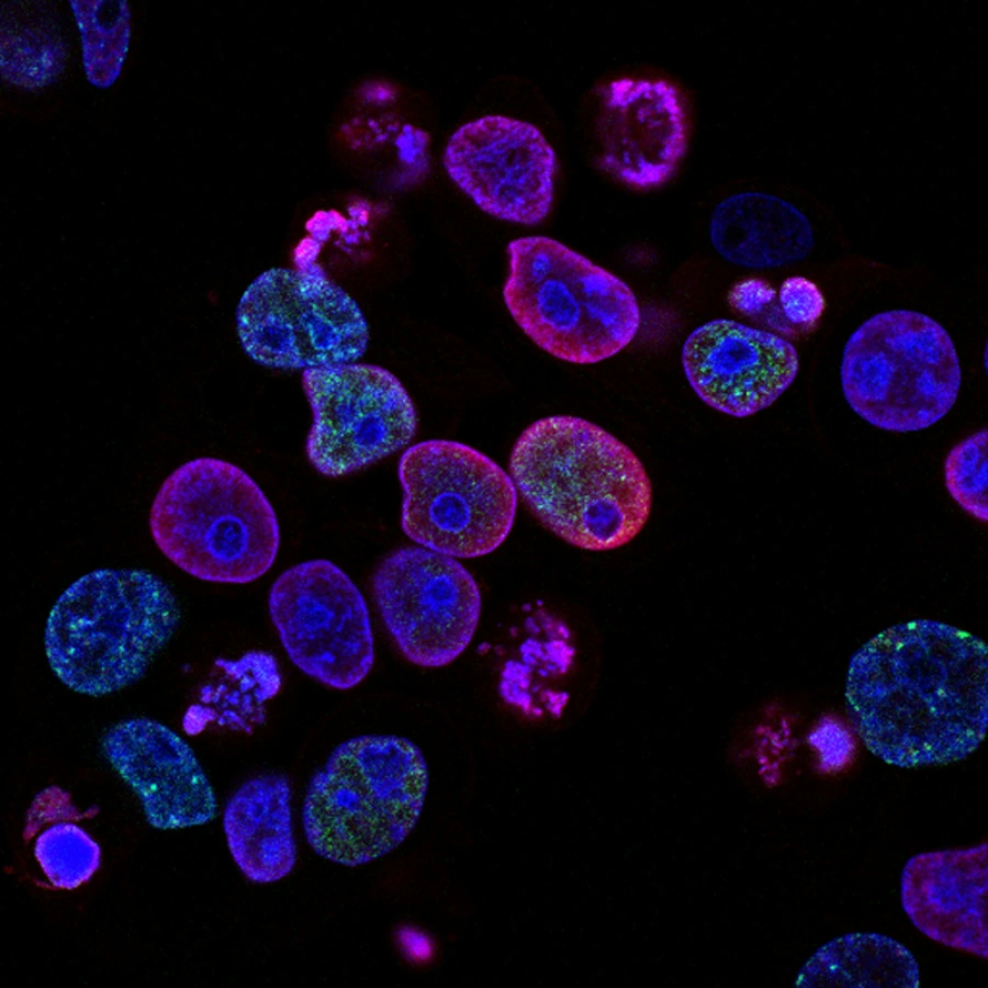 Image of Cancer cells